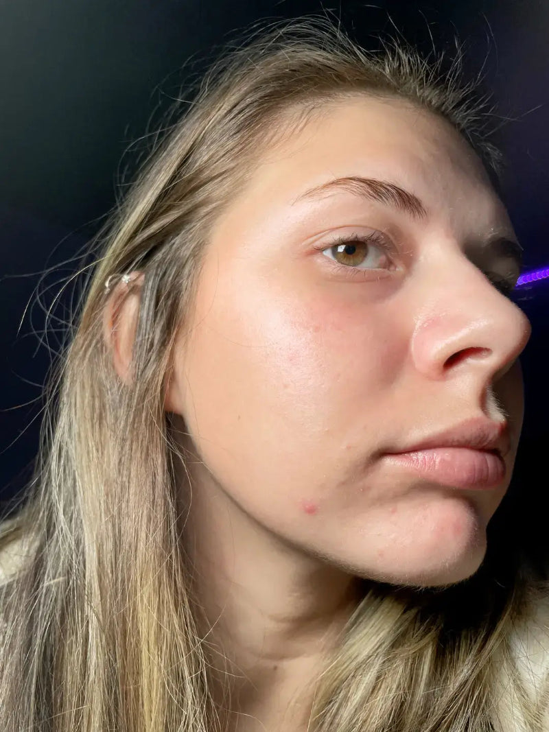 INNOWAVE™ LED Light Therapy Mask