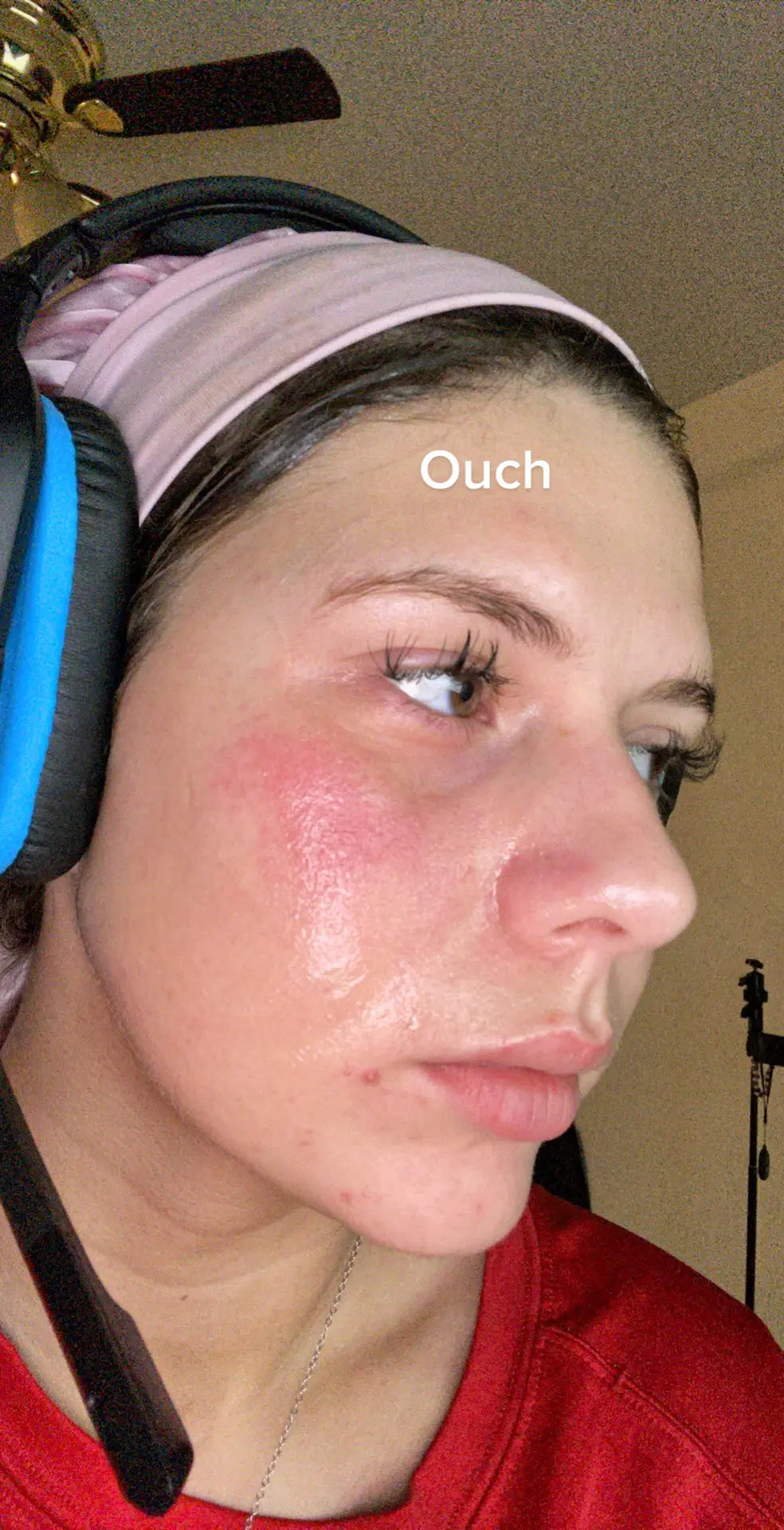 INNOWAVE™ LED Light Therapy Mask
