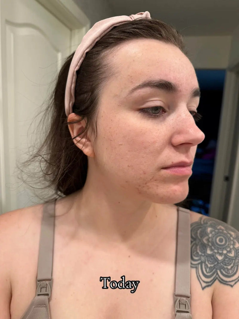 INNOWAVE™ LED Light Therapy Mask