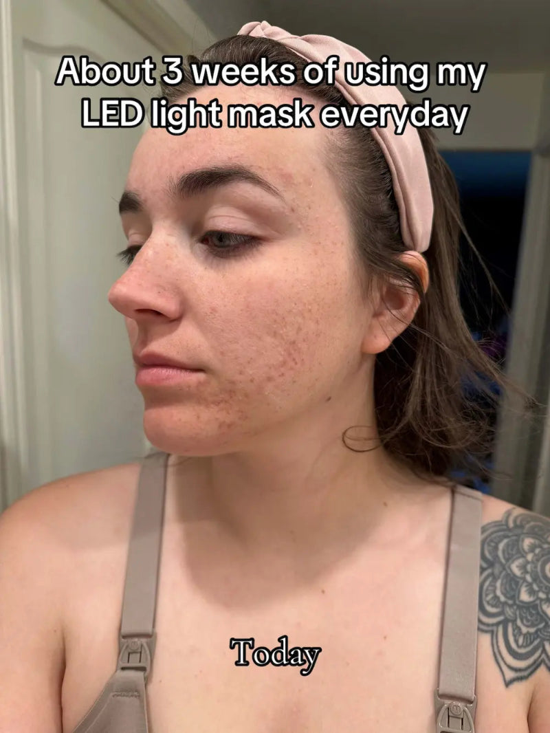 INNOWAVE™ LED Light Therapy Mask