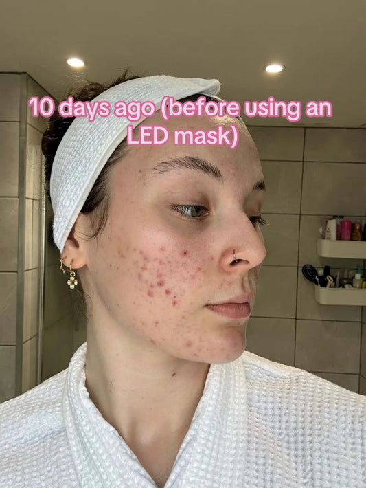 INNOWAVE™ LED Light Therapy Mask